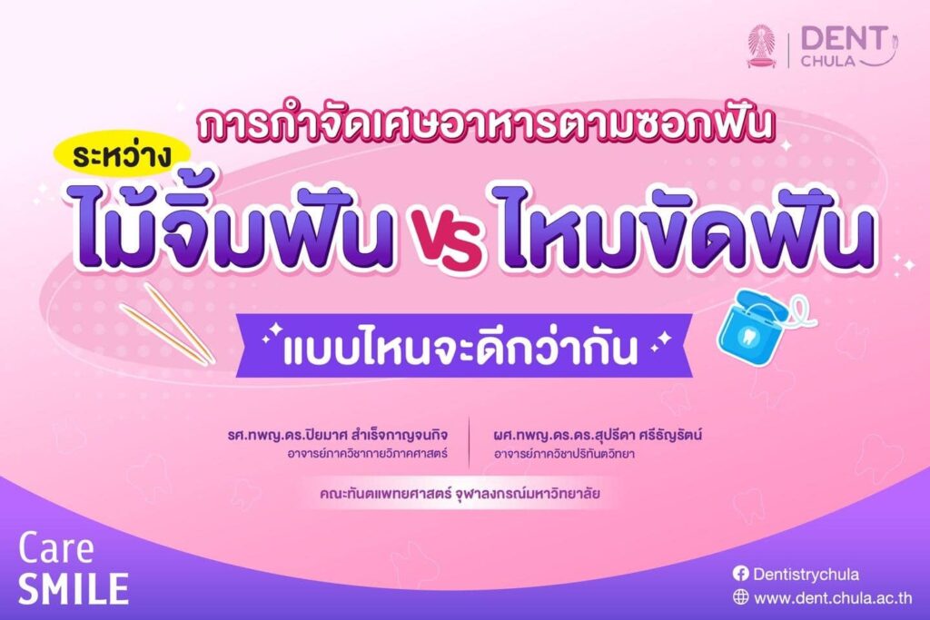 ไม้จิ้มฟัน vs ไหมขัดฟัน 01 0 คณะทันตแพทยศาสตร์ จุฬาลงกรณ์มหาวิทยาลัย