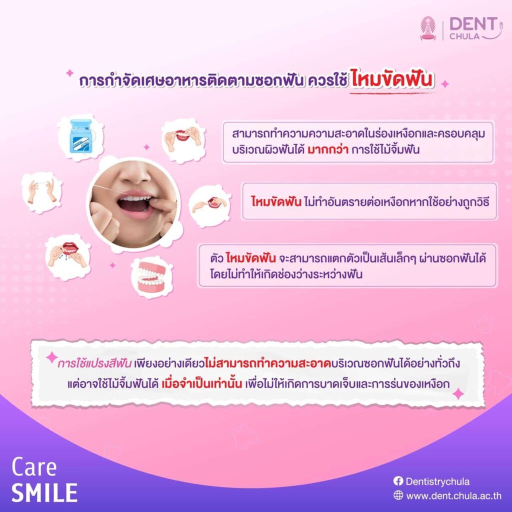 ไม้จิ้มฟัน vs ไหมขัดฟัน 04 0 คณะทันตแพทยศาสตร์ จุฬาลงกรณ์มหาวิทยาลัย