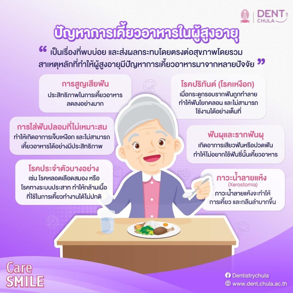 การดูแลสุขภาพช่องปากผู้สูงอายุ 02 คณะทันตแพทยศาสตร์ จุฬาลงกรณ์มหาวิทยาลัย