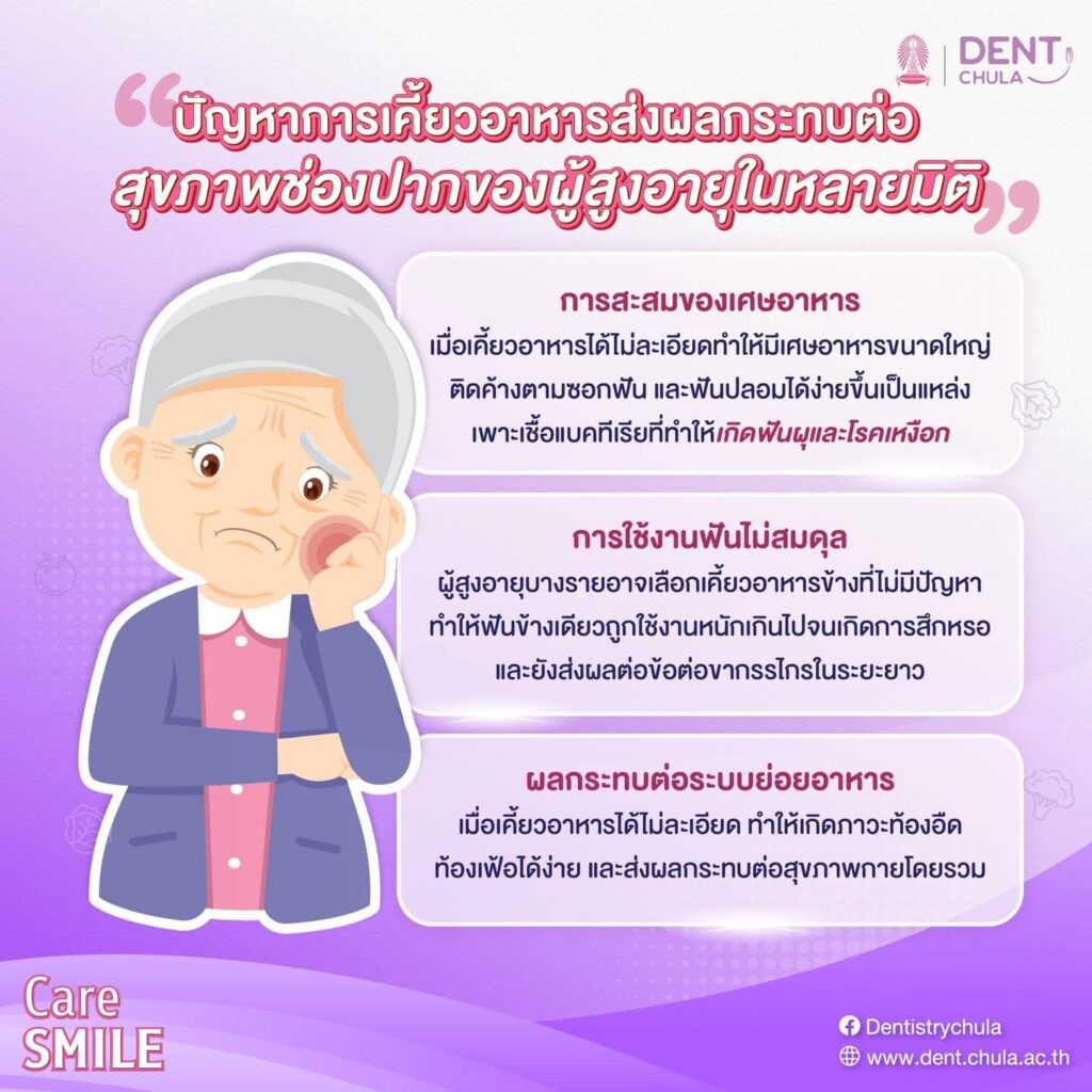การดูแลสุขภาพช่องปากผู้สูงอายุ 03 คณะทันตแพทยศาสตร์ จุฬาลงกรณ์มหาวิทยาลัย