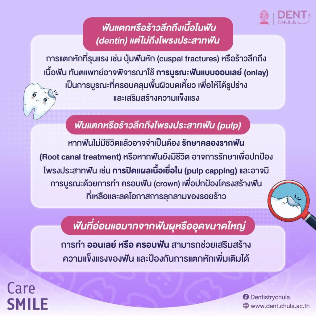 ฟันบิ่นหรือฟันแตก 03 คณะทันตแพทยศาสตร์ จุฬาลงกรณ์มหาวิทยาลัย