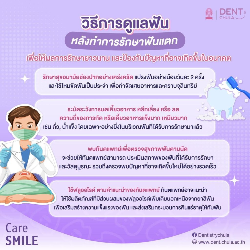 ฟันบิ่นหรือฟันแตก 05 คณะทันตแพทยศาสตร์ จุฬาลงกรณ์มหาวิทยาลัย