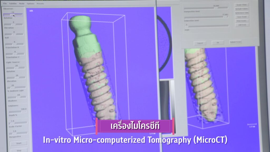 ภาพวิจัย 26 คณะทันตแพทยศาสตร์ จุฬาลงกรณ์มหาวิทยาลัย