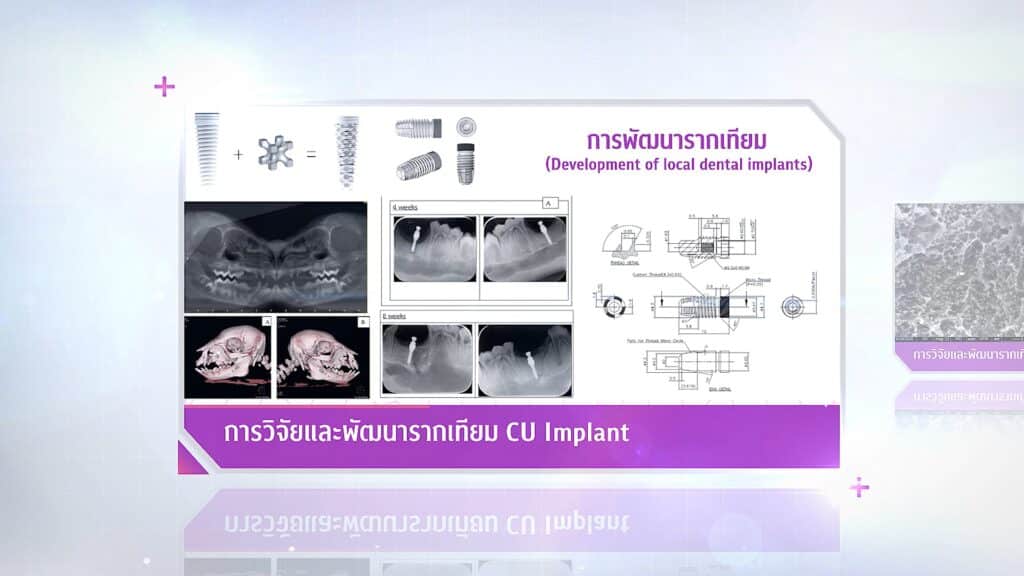 ภาพวิจัย 27 คณะทันตแพทยศาสตร์ จุฬาลงกรณ์มหาวิทยาลัย