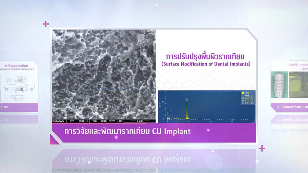ภาพวิจัย 28 คณะทันตแพทยศาสตร์ จุฬาลงกรณ์มหาวิทยาลัย