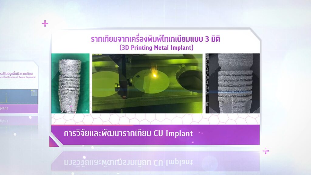 ภาพวิจัย 29 คณะทันตแพทยศาสตร์ จุฬาลงกรณ์มหาวิทยาลัย