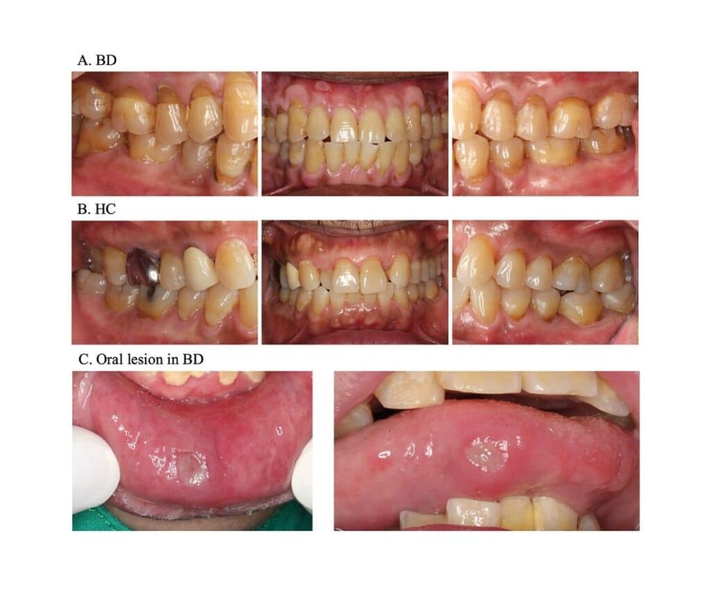 Template ภาพประกอบ Research Highlights 1 คณะทันตแพทยศาสตร์ จุฬาลงกรณ์มหาวิทยาลัย
