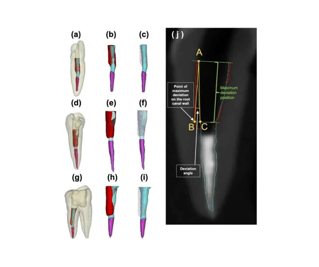 Template ภาพประกอบ Research Highlights 17 Faculty of Dentistry, Chulalongkorn University