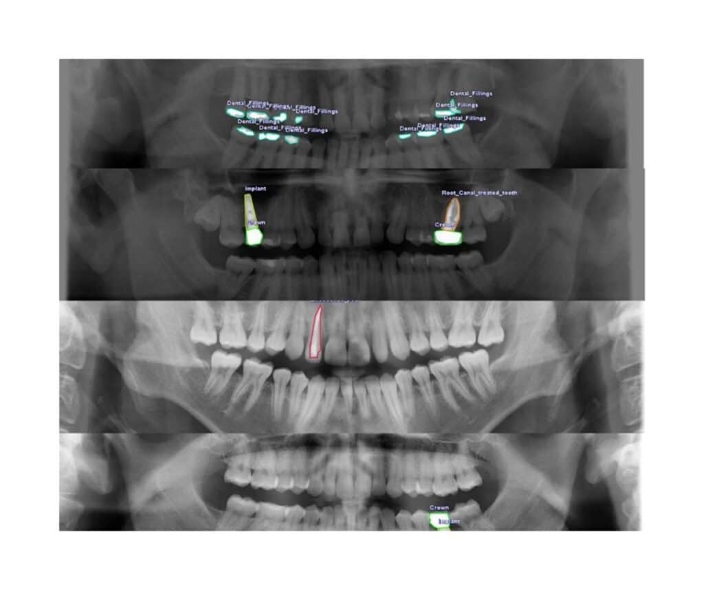 Template ภาพประกอบ Research Highlights 2 คณะทันตแพทยศาสตร์ จุฬาลงกรณ์มหาวิทยาลัย