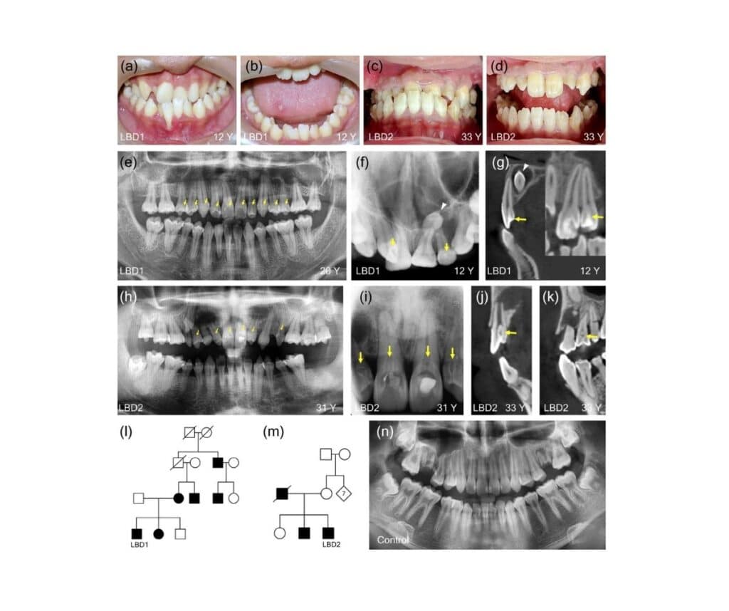 Template ภาพประกอบ Research Highlights 20 Faculty of Dentistry, Chulalongkorn University