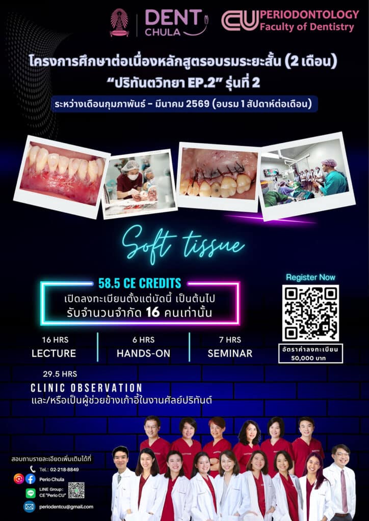 โปสเตอร์ประชาสัมพันธ์ CE EP2 NO2 2026 คณะทันตแพทยศาสตร์ จุฬาลงกรณ์มหาวิทยาลัย
