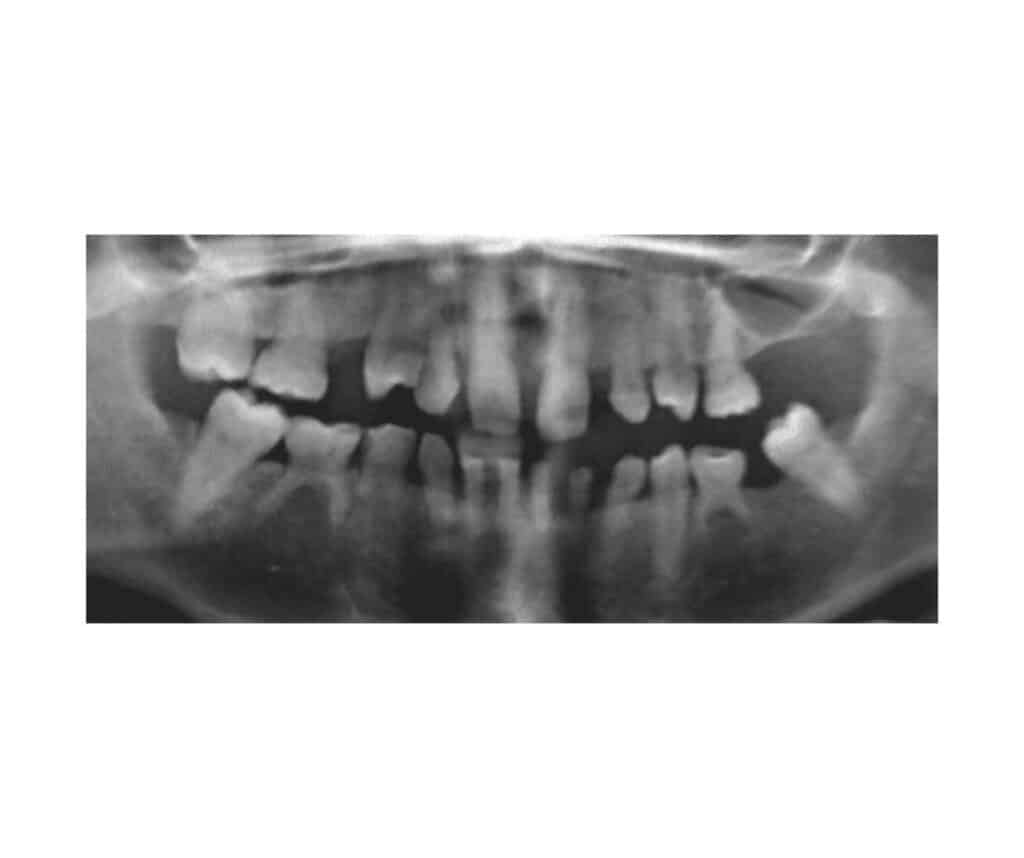 Template ภาพประกอบ Research Highlights 29 คณะทันตแพทยศาสตร์ จุฬาลงกรณ์มหาวิทยาลัย
