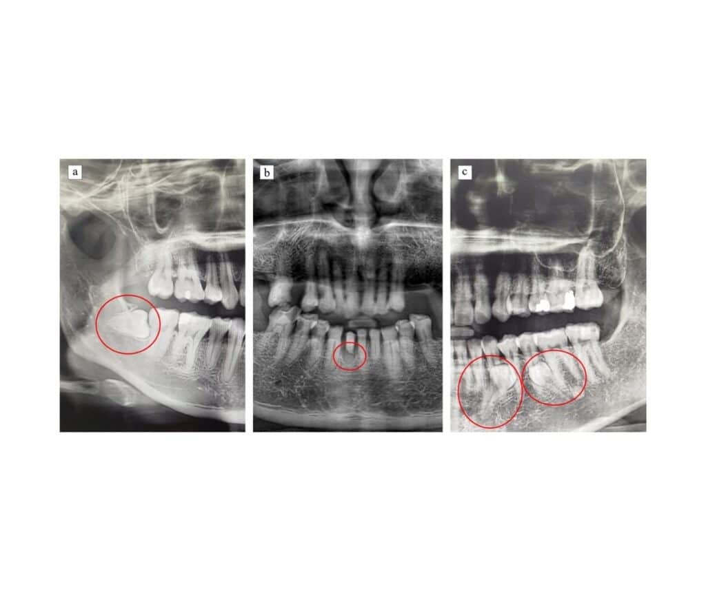 Template ภาพประกอบ Research Highlights 32 คณะทันตแพทยศาสตร์ จุฬาลงกรณ์มหาวิทยาลัย