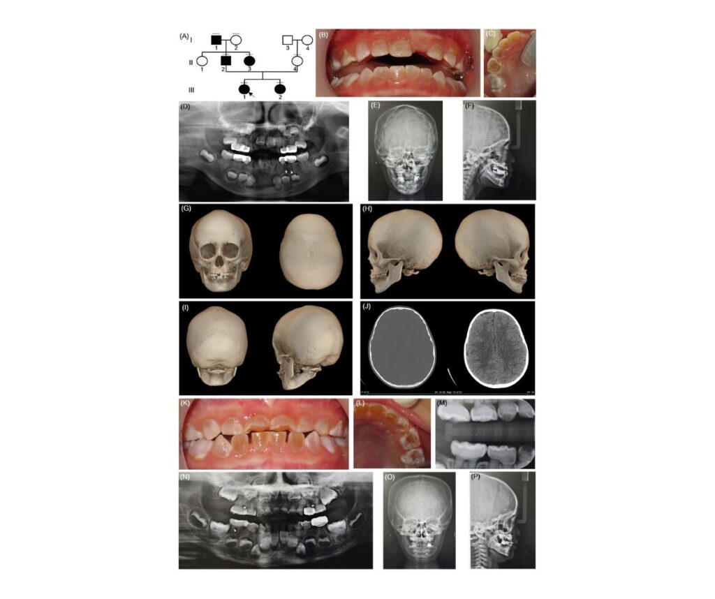 Template ภาพประกอบ Research Highlights 36 คณะทันตแพทยศาสตร์ จุฬาลงกรณ์มหาวิทยาลัย