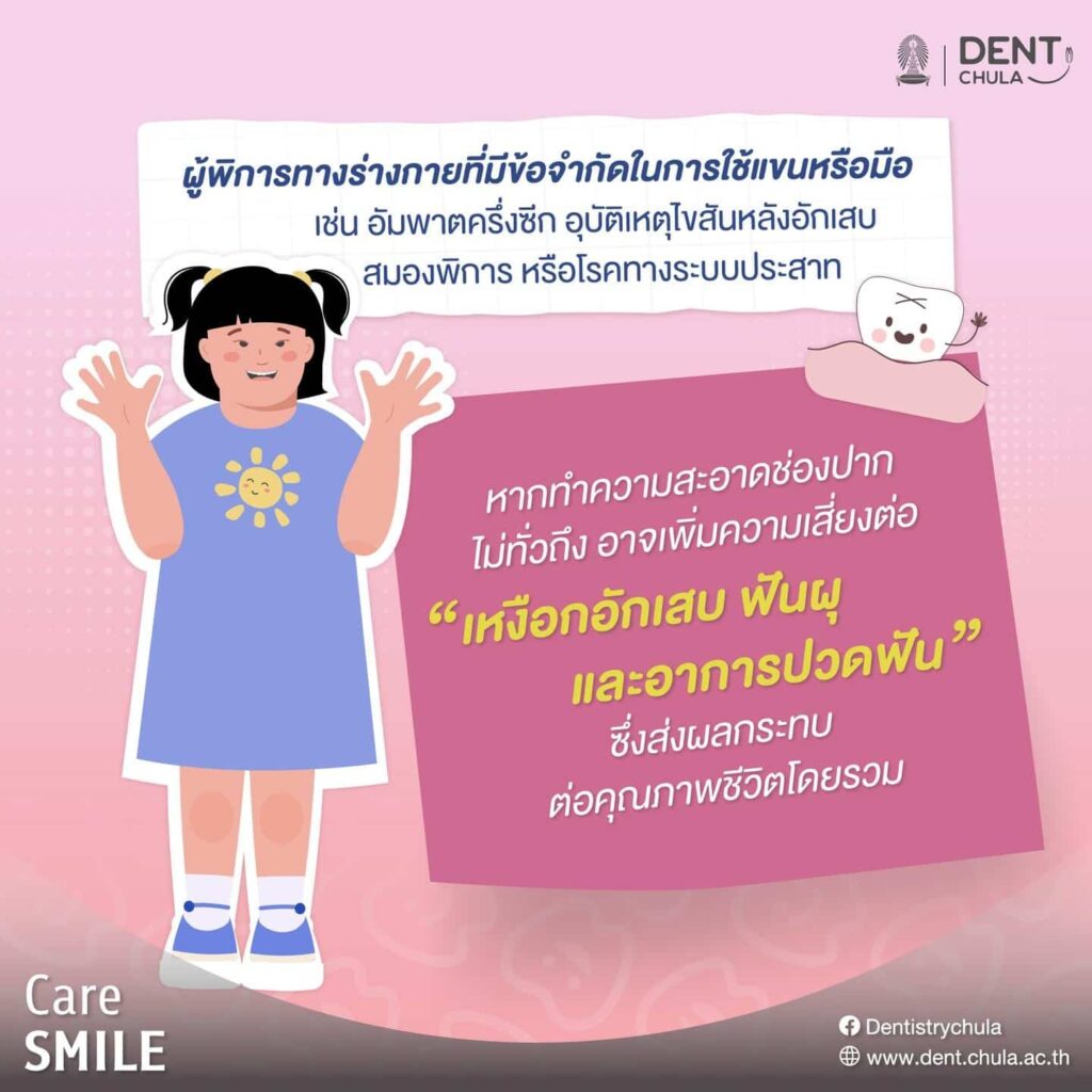 การทำความสะอาดช่องปากในผู้พิการทางร่างกาย 02 คณะทันตแพทยศาสตร์ จุฬาลงกรณ์มหาวิทยาลัย