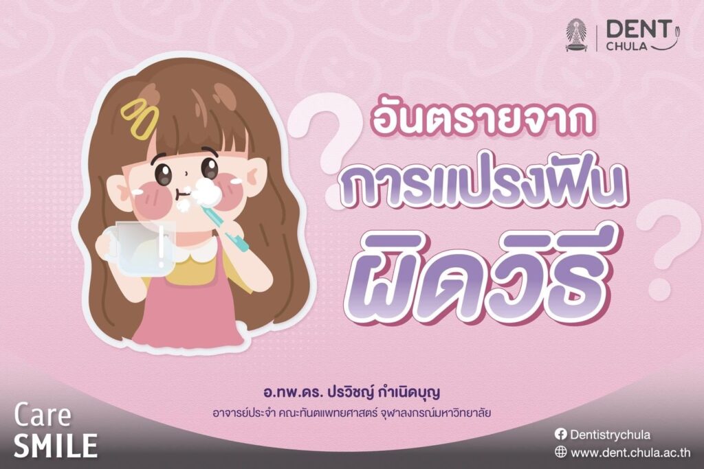 การแปรงฟันผิดวิธี 01 คณะทันตแพทยศาสตร์ จุฬาลงกรณ์มหาวิทยาลัย