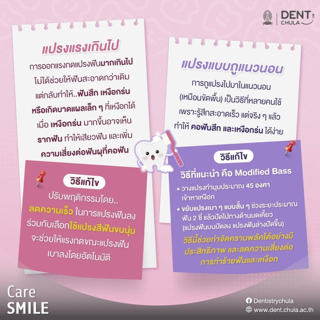 การแปรงฟันผิดวิธี 02 คณะทันตแพทยศาสตร์ จุฬาลงกรณ์มหาวิทยาลัย