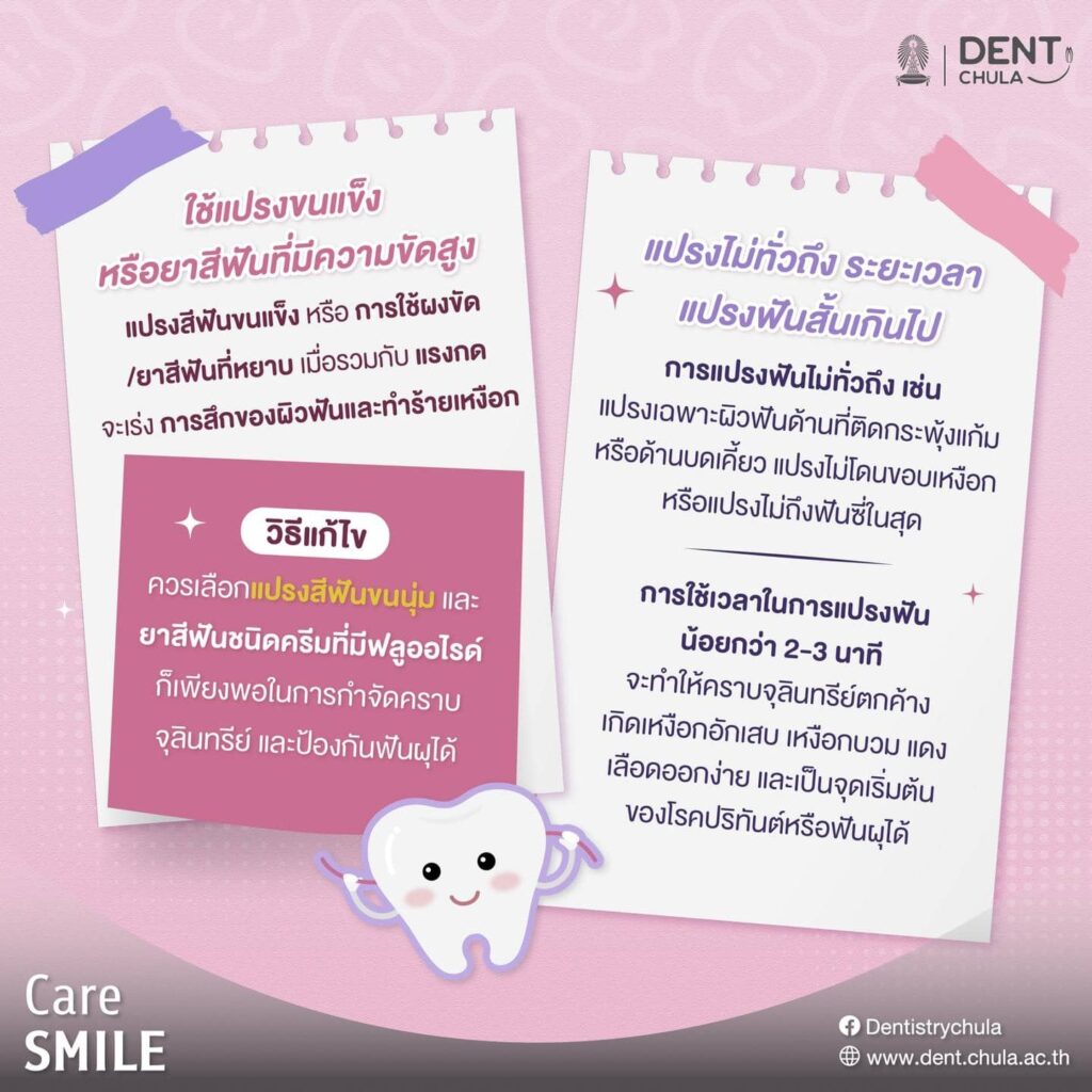 การแปรงฟันผิดวิธี 03 คณะทันตแพทยศาสตร์ จุฬาลงกรณ์มหาวิทยาลัย