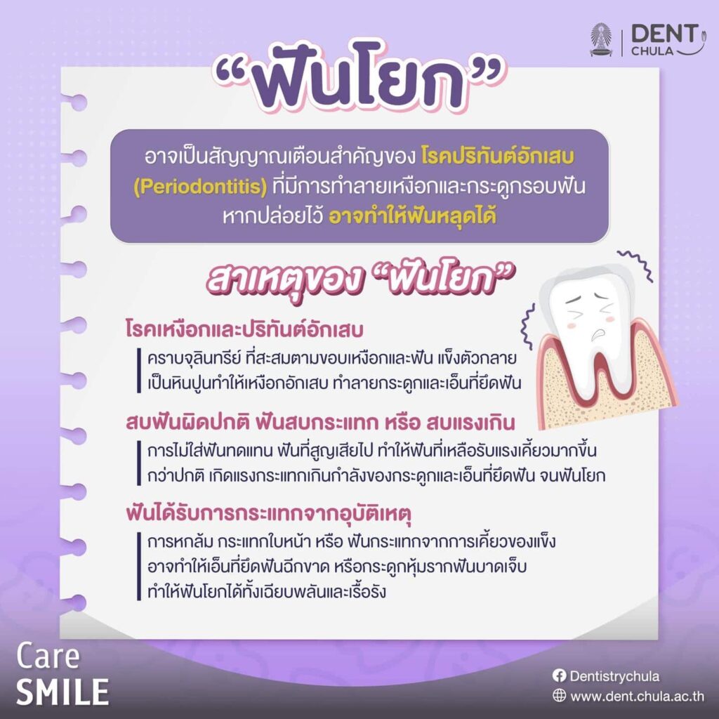ฟันโยกvsผู้สูงวัย 02 คณะทันตแพทยศาสตร์ จุฬาลงกรณ์มหาวิทยาลัย
