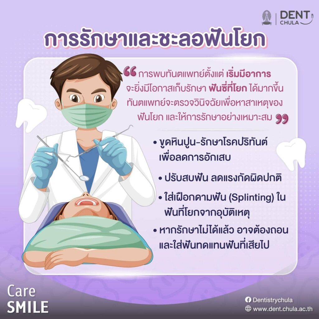 ฟันโยกvsผู้สูงวัย 03 คณะทันตแพทยศาสตร์ จุฬาลงกรณ์มหาวิทยาลัย