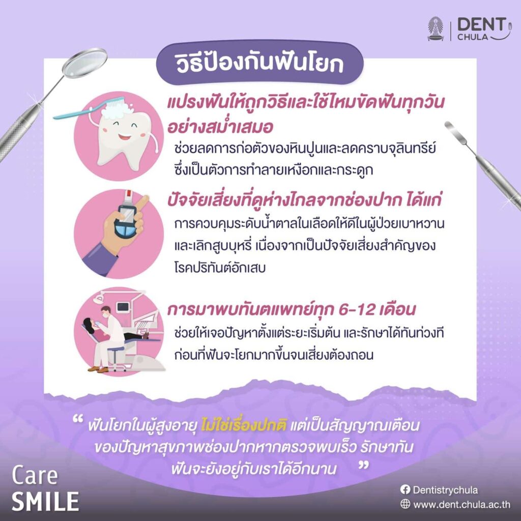 ฟันโยกvsผู้สูงวัย 04 คณะทันตแพทยศาสตร์ จุฬาลงกรณ์มหาวิทยาลัย