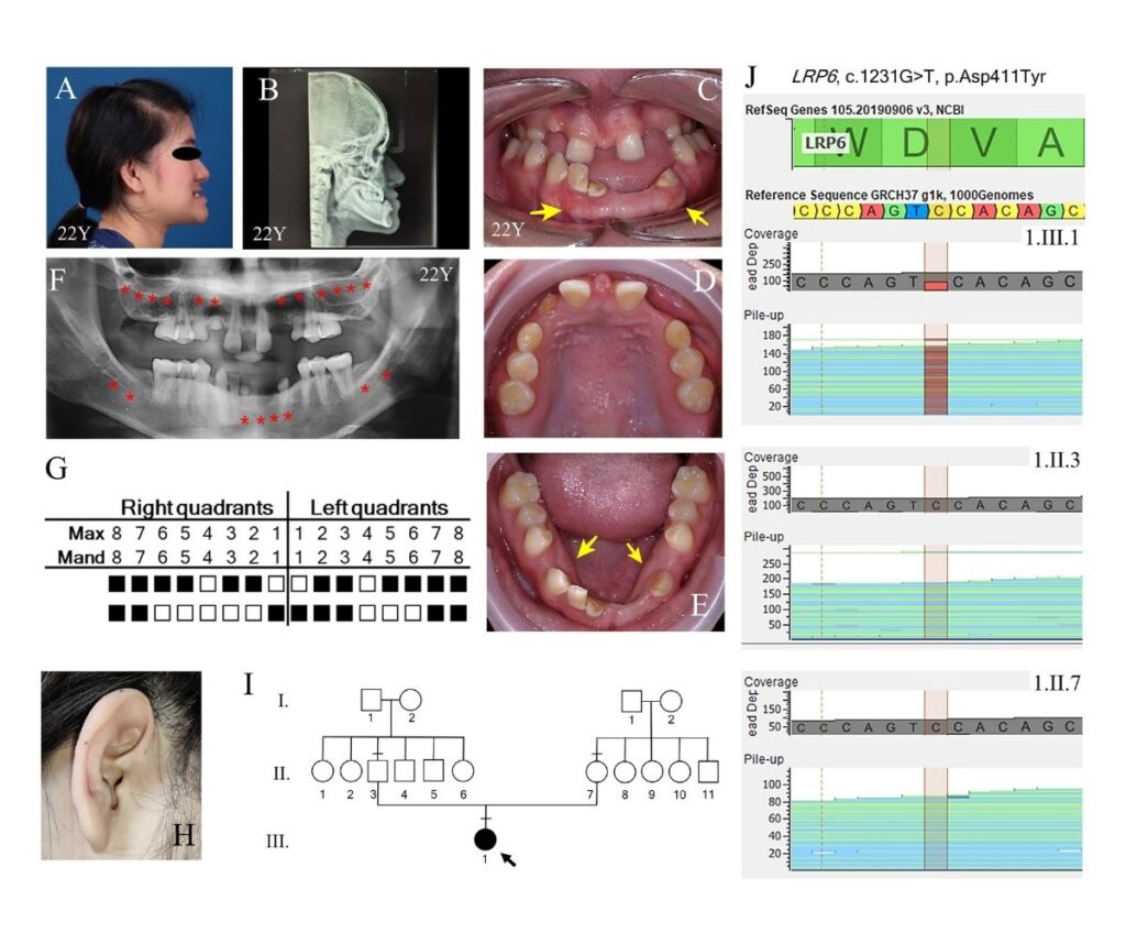 Template ภาพประกอบ Research Highlights 5 คณะทันตแพทยศาสตร์ จุฬาลงกรณ์มหาวิทยาลัย