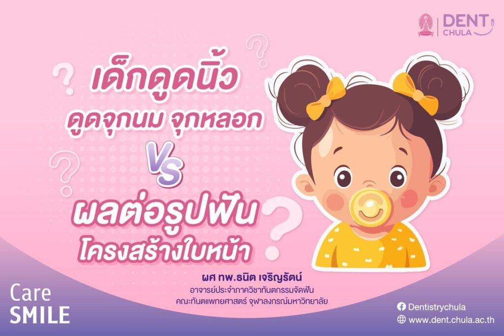 เด็กดูดนิ้วมือ 01 คณะทันตแพทยศาสตร์ จุฬาลงกรณ์มหาวิทยาลัย