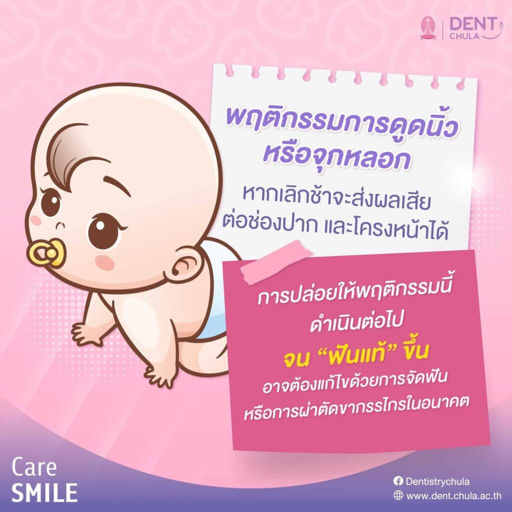 เด็กดูดนิ้วมือ 02 คณะทันตแพทยศาสตร์ จุฬาลงกรณ์มหาวิทยาลัย