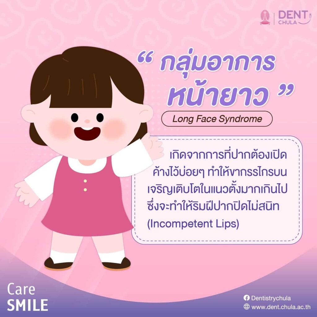 เด็กดูดนิ้วมือ 05 คณะทันตแพทยศาสตร์ จุฬาลงกรณ์มหาวิทยาลัย