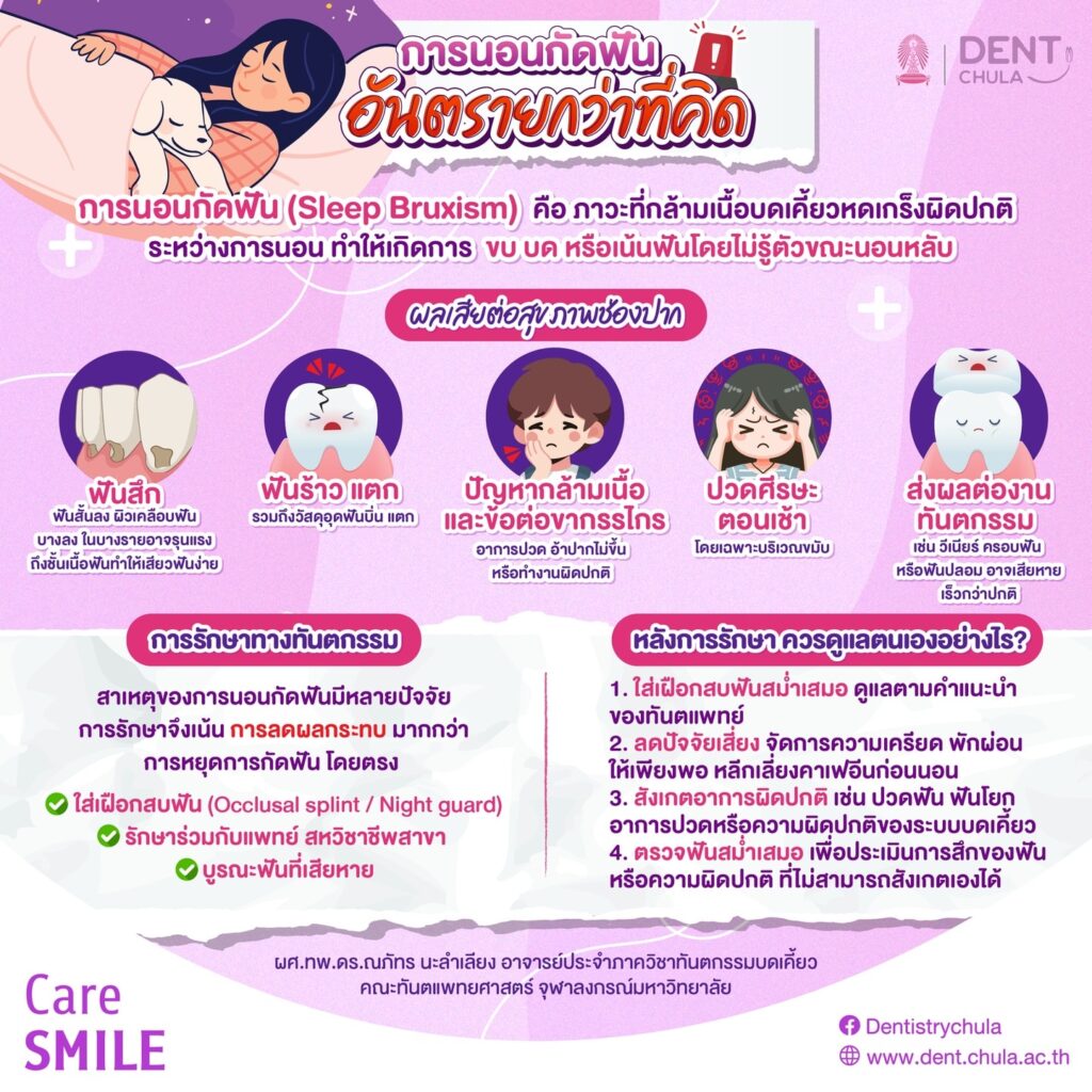 การป้องกันการกัดฟันระหว่างนอน คณะทันตแพทยศาสตร์ จุฬาลงกรณ์มหาวิทยาลัย