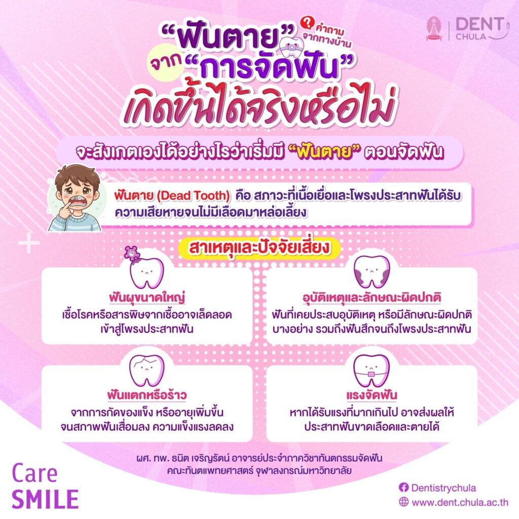 ฟันตาย จาก การจัดฟัน 01 0 คณะทันตแพทยศาสตร์ จุฬาลงกรณ์มหาวิทยาลัย