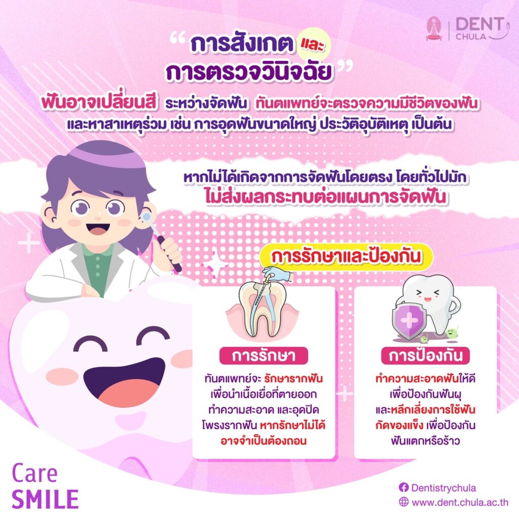 ฟันตาย จาก การจัดฟัน 02 0 คณะทันตแพทยศาสตร์ จุฬาลงกรณ์มหาวิทยาลัย