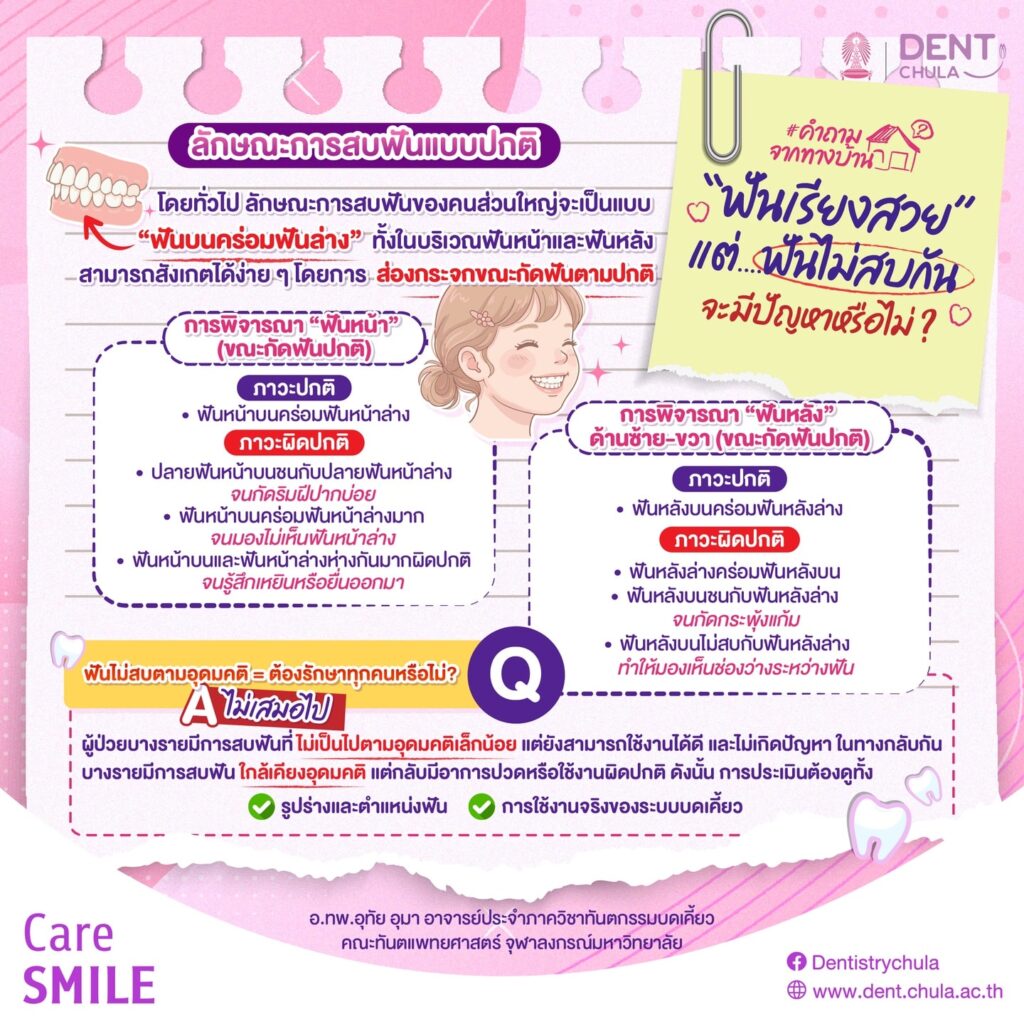 ฟันเรียงสวย แต่สบฟันผิดปกติ ปล่อยไปได้มั้ย คณะทันตแพทยศาสตร์ จุฬาลงกรณ์มหาวิทยาลัย