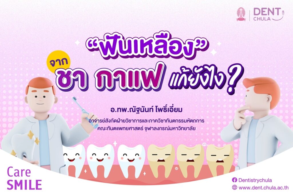 ฟันเหลือง 01 0 คณะทันตแพทยศาสตร์ จุฬาลงกรณ์มหาวิทยาลัย