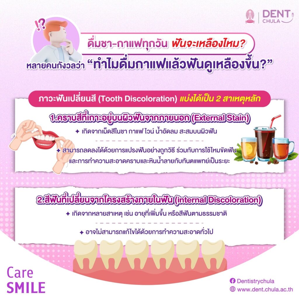 ฟันเหลือง 02 0 คณะทันตแพทยศาสตร์ จุฬาลงกรณ์มหาวิทยาลัย