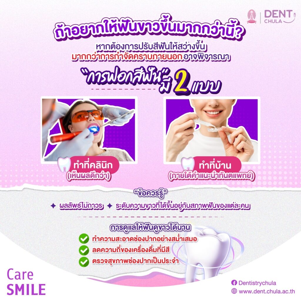 ฟันเหลือง 04 0 คณะทันตแพทยศาสตร์ จุฬาลงกรณ์มหาวิทยาลัย
