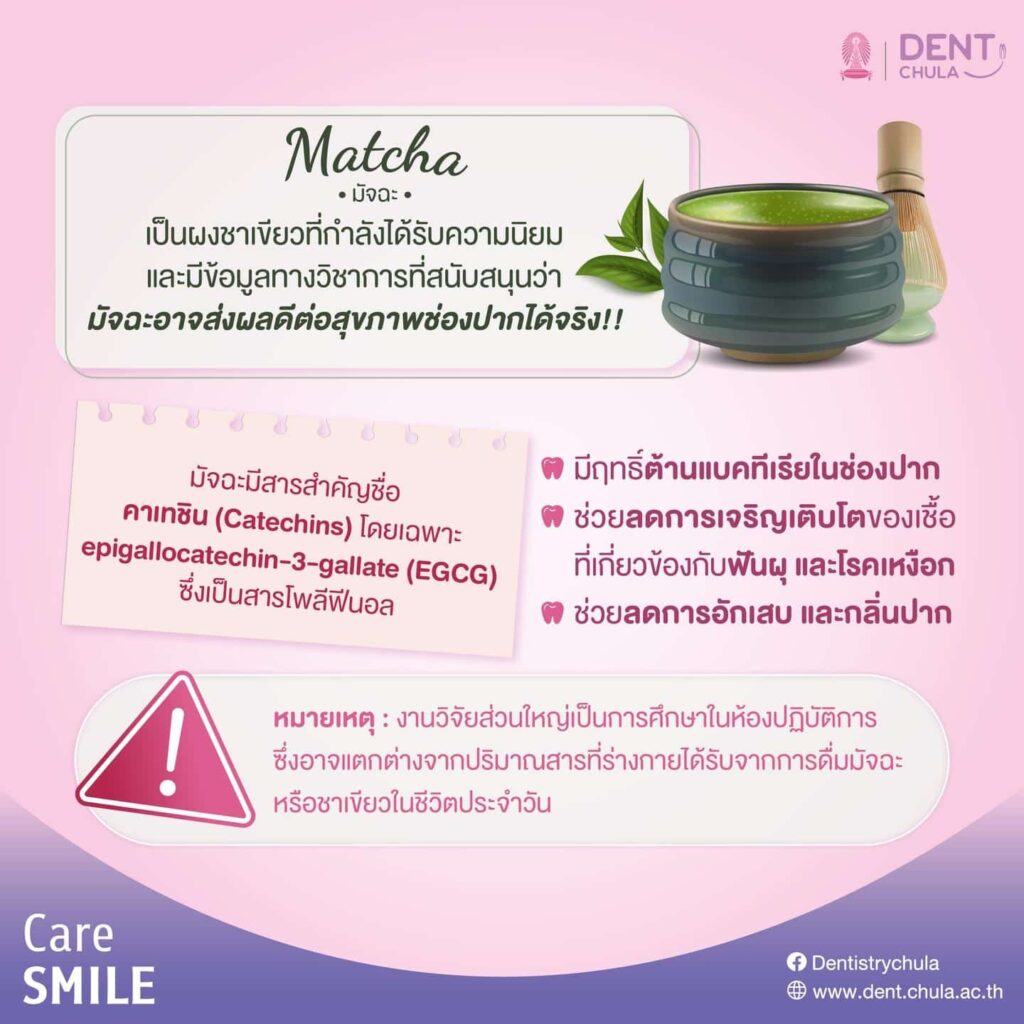 มัจฉะ 02 คณะทันตแพทยศาสตร์ จุฬาลงกรณ์มหาวิทยาลัย