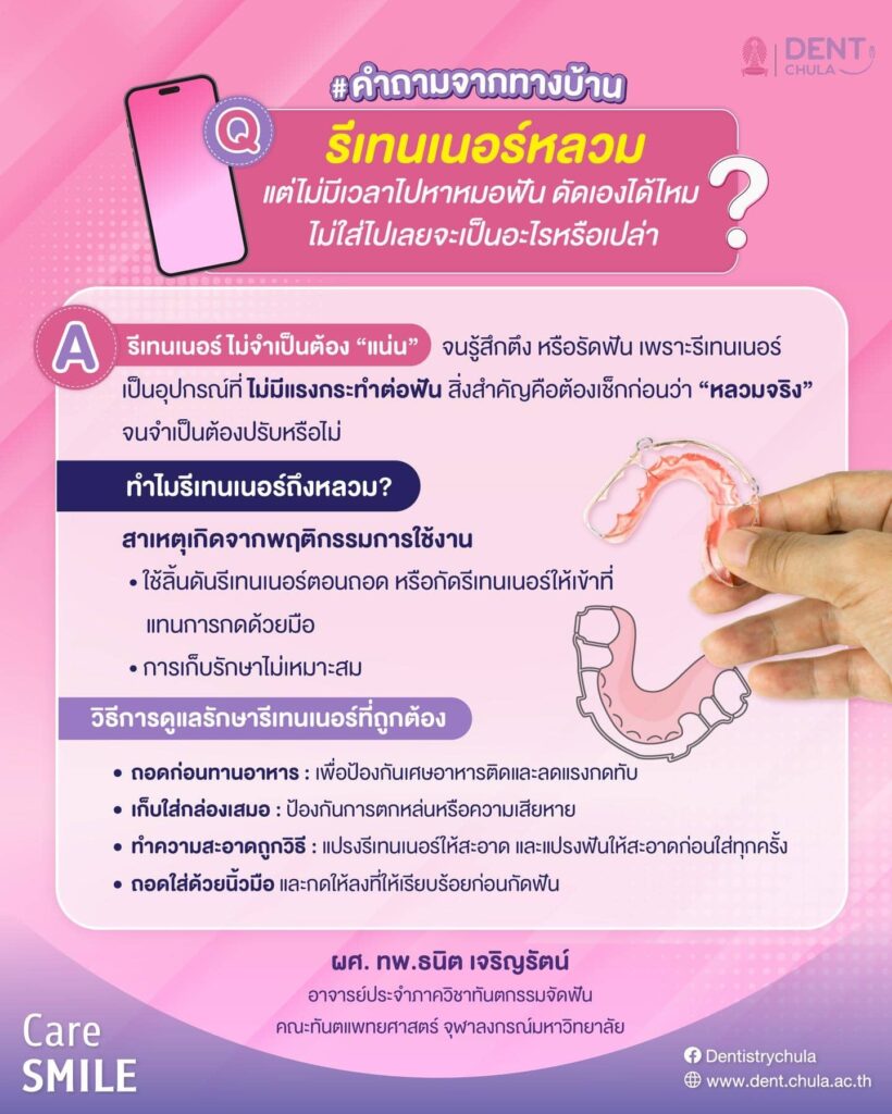 รีเทนเนอร์ คณะทันตแพทยศาสตร์ จุฬาลงกรณ์มหาวิทยาลัย