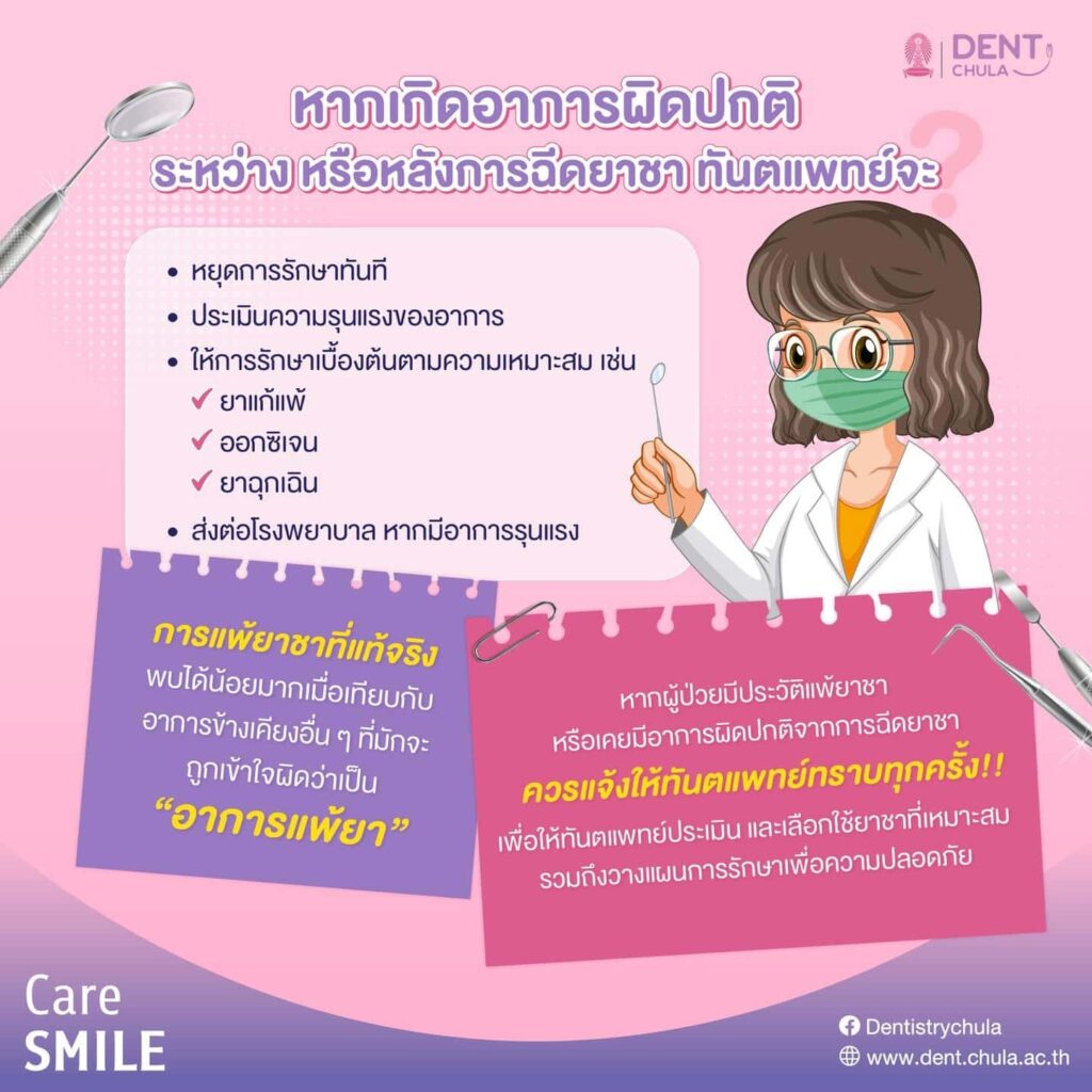 แพ้ยาชา 02 คณะทันตแพทยศาสตร์ จุฬาลงกรณ์มหาวิทยาลัย