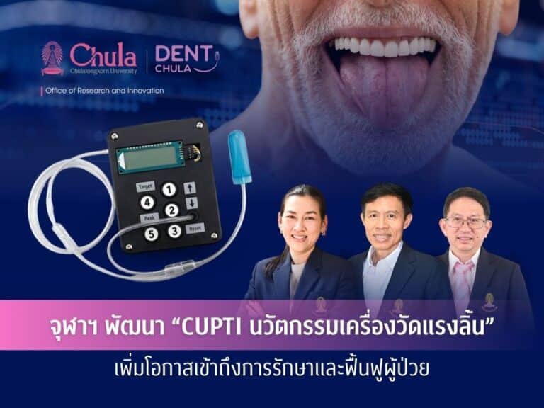 จุฬาฯ พัฒนา “CUPTI นวัตกรรมเครื่องวัดแรงลิ้น” เพิ่มโอกาสเข้าถึงการรักษาและฟื้นฟูผู้ป่วย