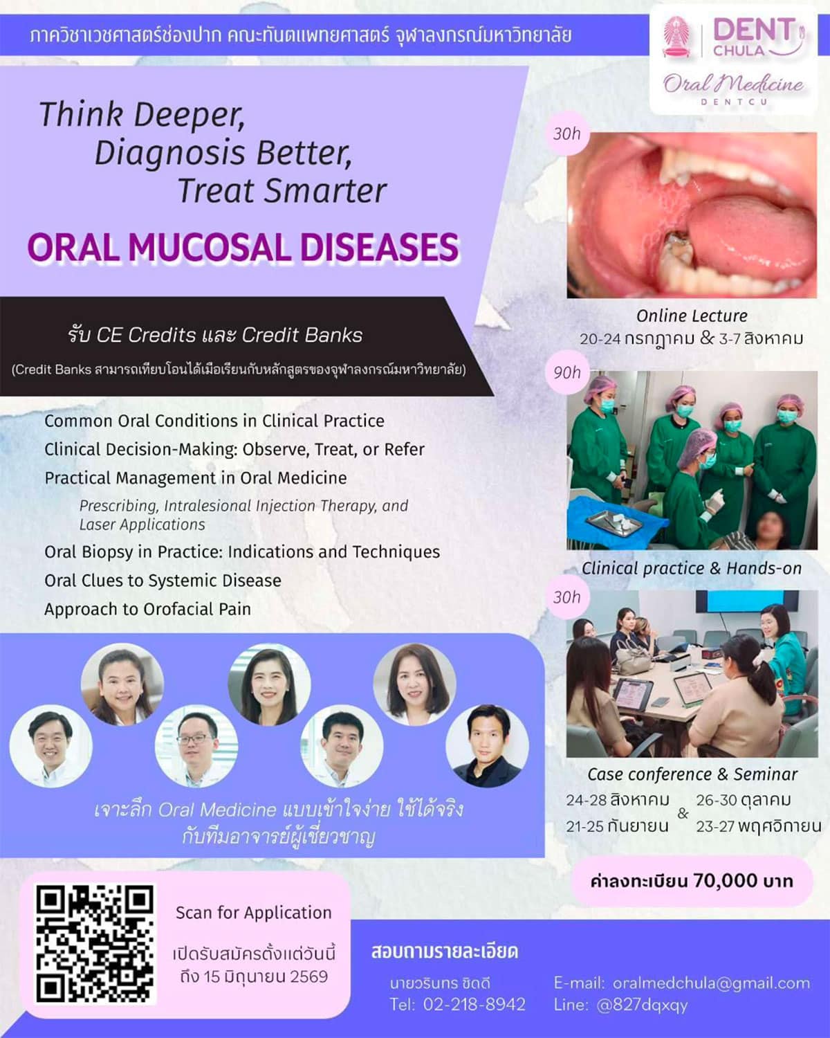 โครงการ Think Deeper, Diagnose Better, Treat Smarter: Oral Mucosal Diseases