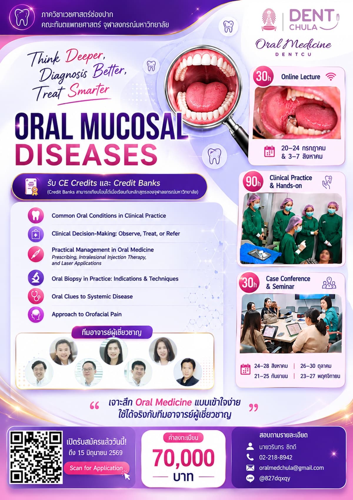 โครงการ Think Deeper, Diagnose Better, Treat Smarter: Oral Mucosal Diseases