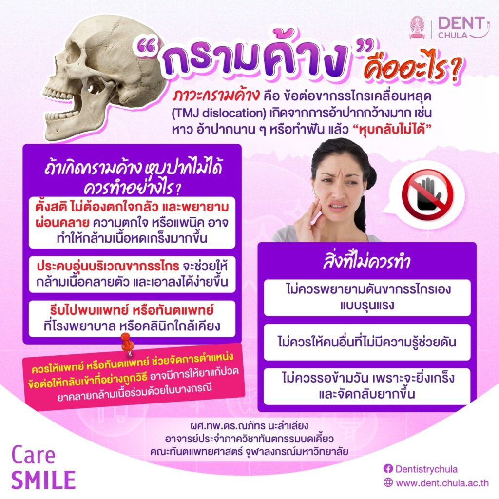 กรามค้าง 1 0 คณะทันตแพทยศาสตร์ จุฬาลงกรณ์มหาวิทยาลัย