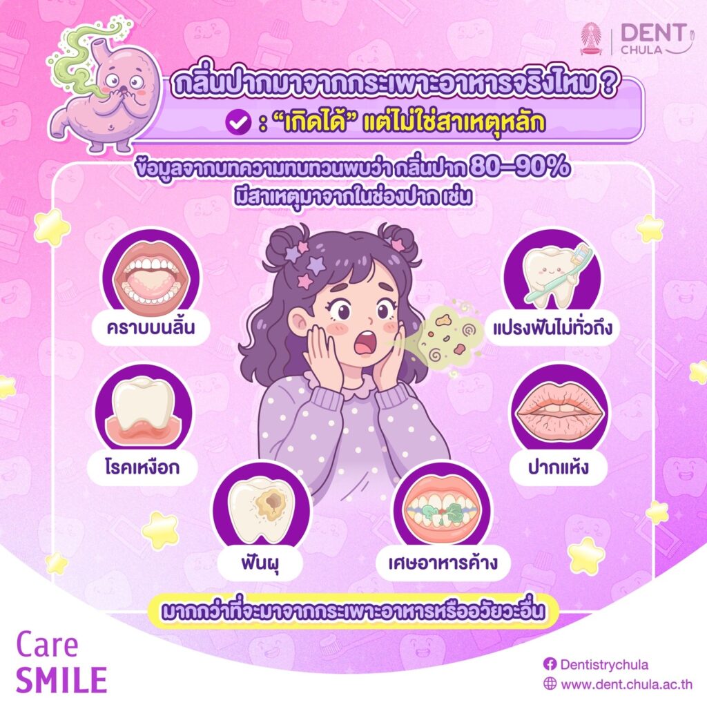 กลิ่นปาก 2 0 คณะทันตแพทยศาสตร์ จุฬาลงกรณ์มหาวิทยาลัย