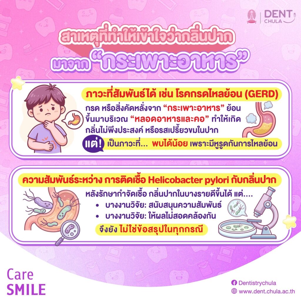 กลิ่นปาก 3 0 คณะทันตแพทยศาสตร์ จุฬาลงกรณ์มหาวิทยาลัย