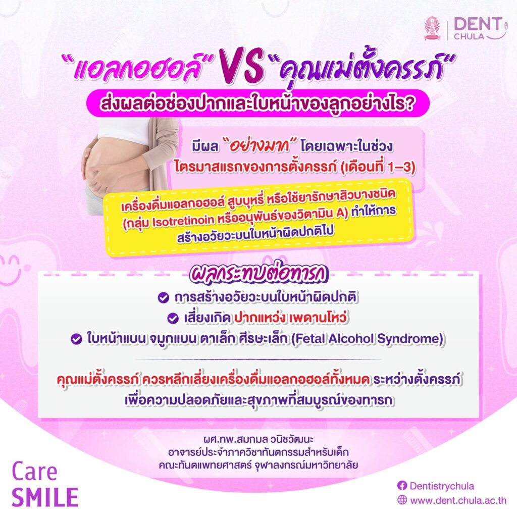 คุณแม่ตั้งครรภ์ดื่มแอลกอฮอล์กับผลต่อช่องปากเด็กในครรภ์ คณะทันตแพทยศาสตร์ จุฬาลงกรณ์มหาวิทยาลัย