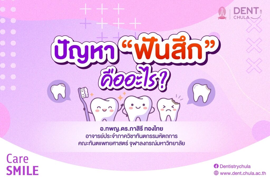 ปัญหาฟันสึก 1 0 คณะทันตแพทยศาสตร์ จุฬาลงกรณ์มหาวิทยาลัย