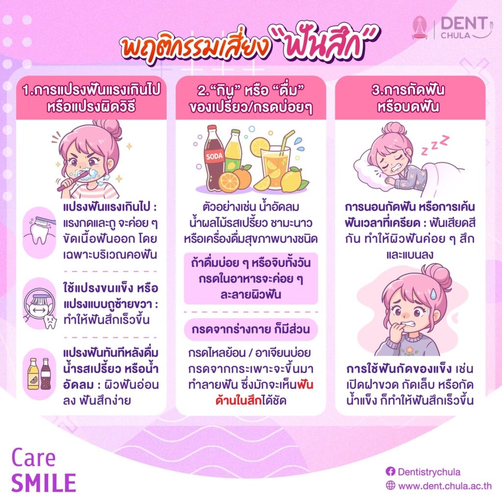 ปัญหาฟันสึก 3 0 คณะทันตแพทยศาสตร์ จุฬาลงกรณ์มหาวิทยาลัย