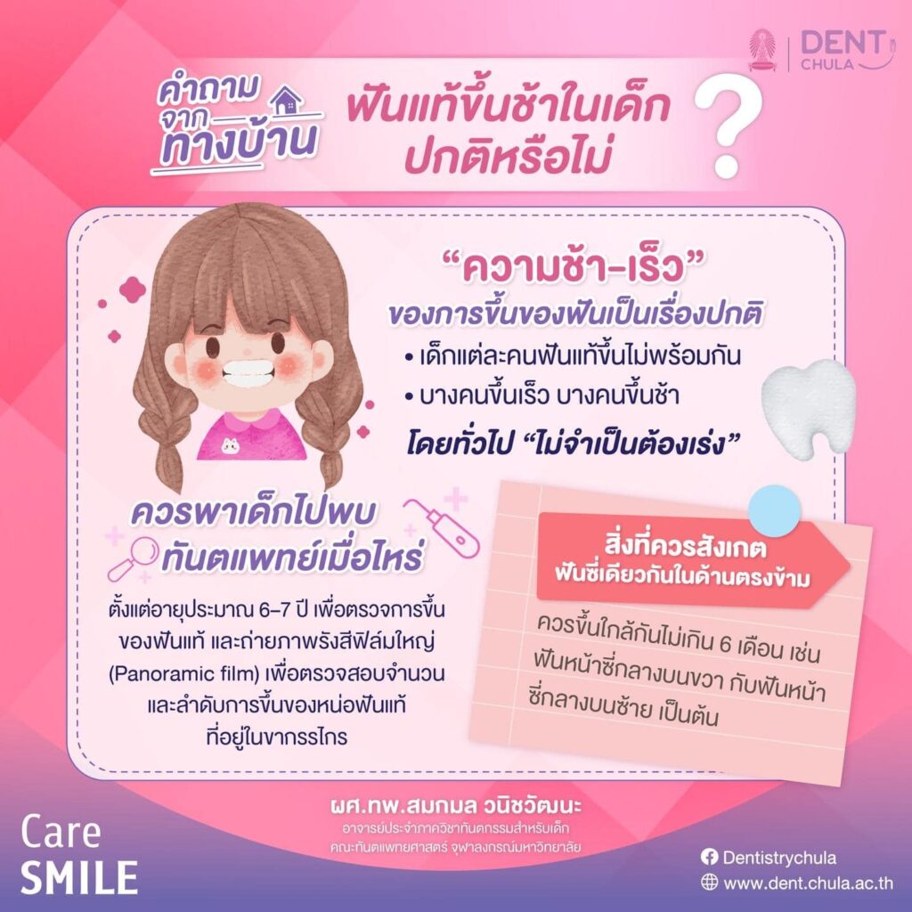 ฟันแท้ขึ้นช้า ผิดปกติหรือไม่ คณะทันตแพทยศาสตร์ จุฬาลงกรณ์มหาวิทยาลัย