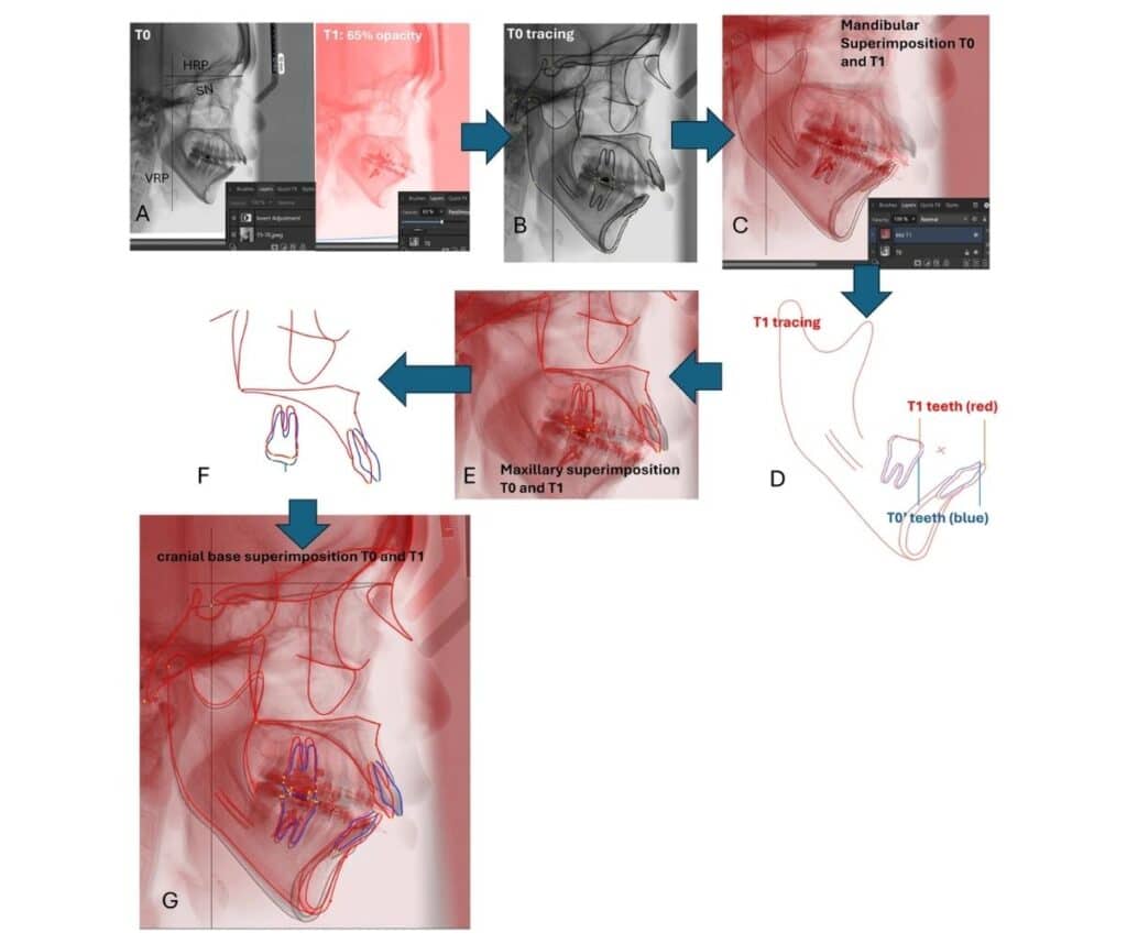 Template ภาพประกอบ Research Highlights 16 Faculty of Dentistry, Chulalongkorn University